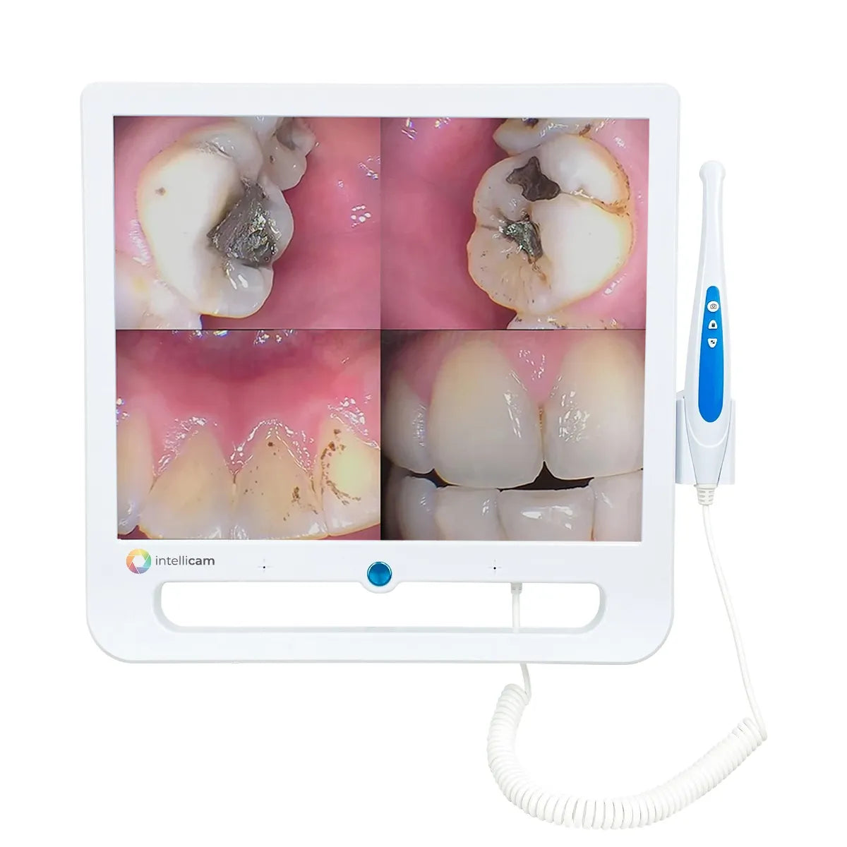 Intellicam 16MP Intraoral Camera with 17" Screen