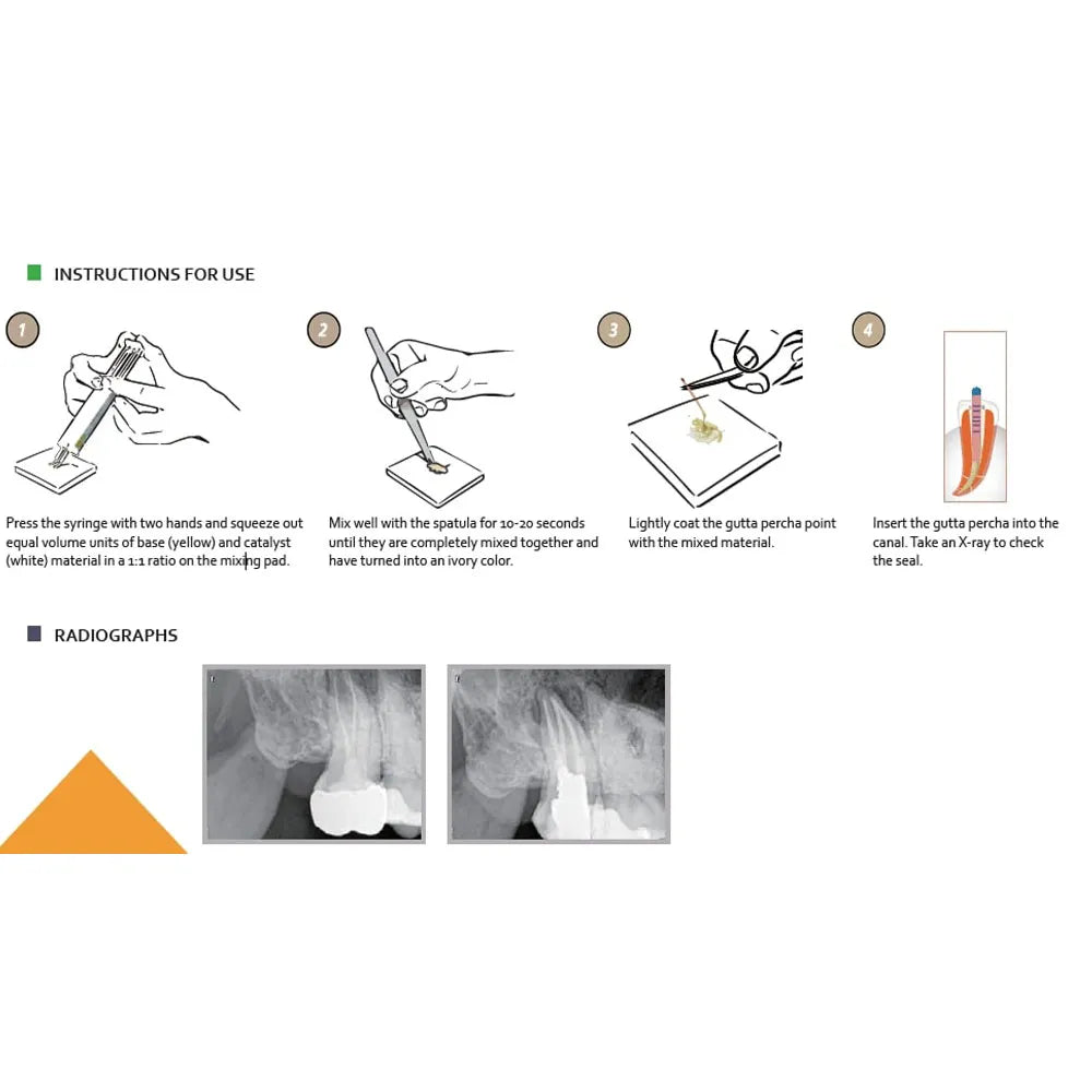 Diadent Dia-Proseal