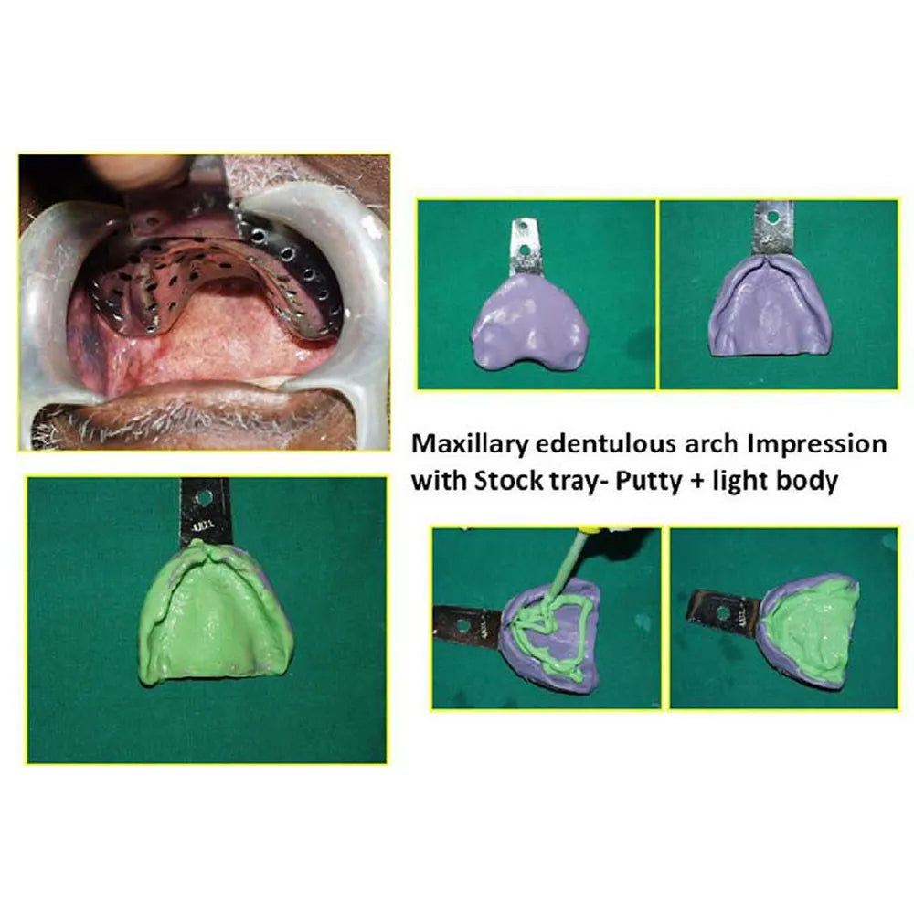 GDC Edentulous Perforated Impression Trays Upper #1 (ITRLEDPU1)