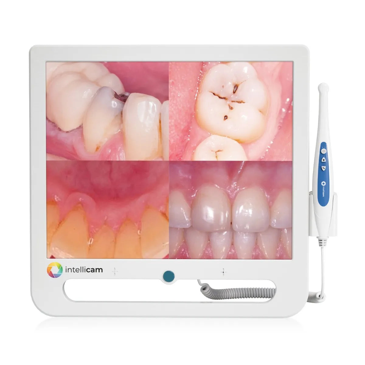 Intellicam 16MP Intraoral Camera with 17