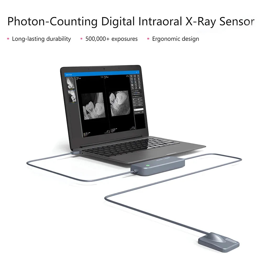 Xpect Vision Intraoral Sensor XVD2530 Size 1.5